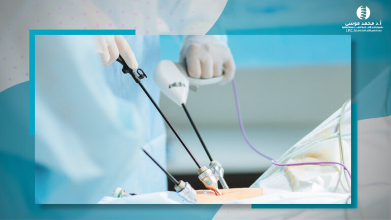 استئصال الغضروف بالمنظار الجانبى بدون فتح جراحى