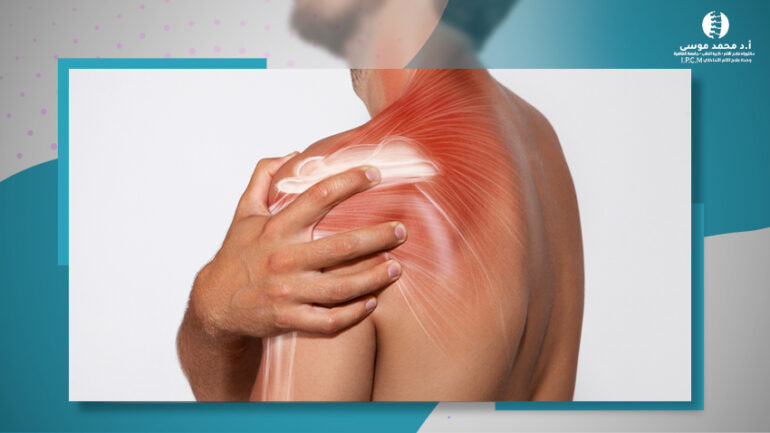 علاج تهتك الاوتار الداخليه لمفصل الكتف بحقن الخلايا النشطه